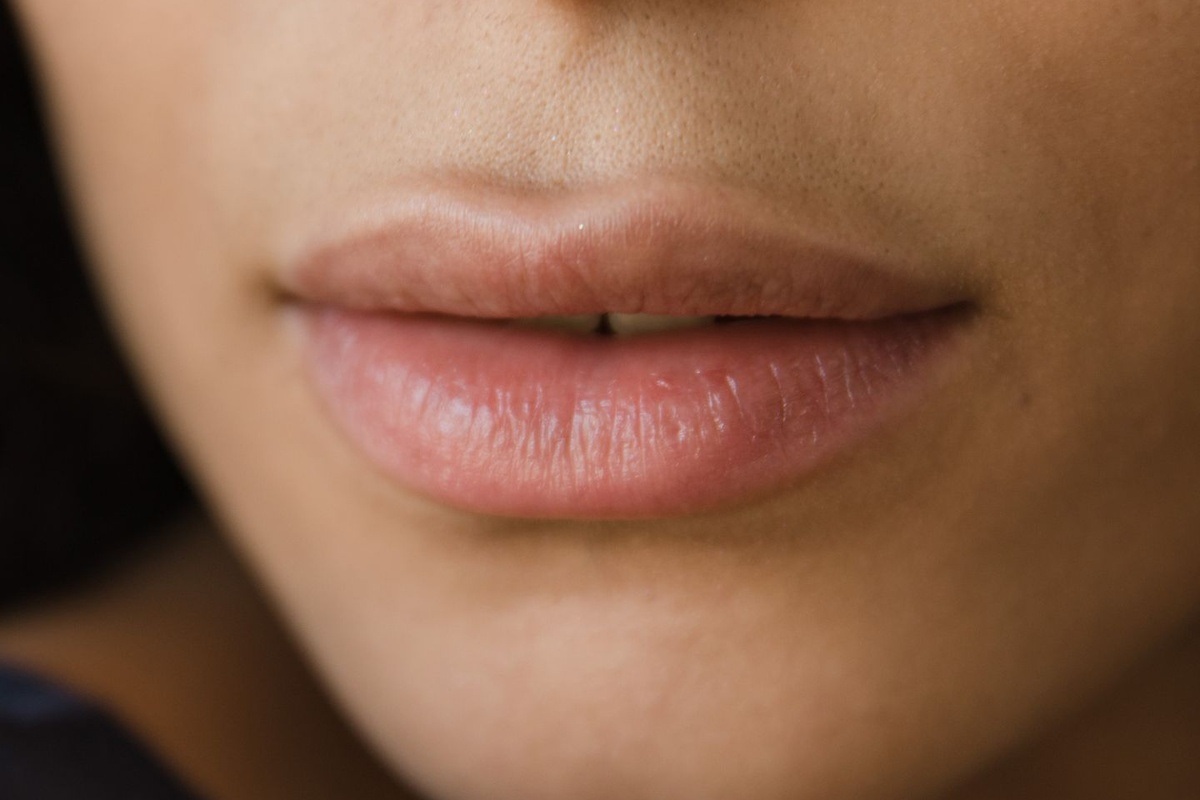 Dermal & Lip Fillers procedure at Clear Skin Clinic Bradford
