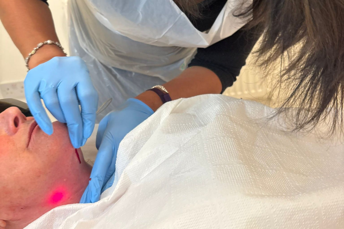 Endolaser Facial Lifting at Clear Skin Clinic Bradford